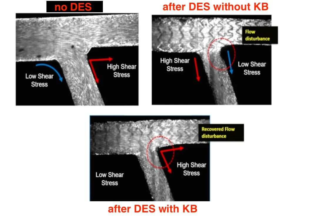 Left main PCI kissing balloon CFD
